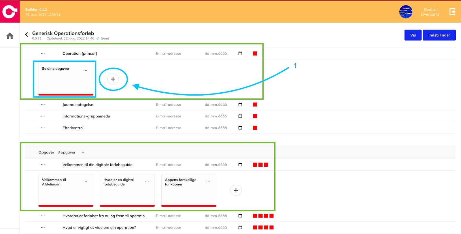 Billede 3: Redigér indholdselementer i Builder